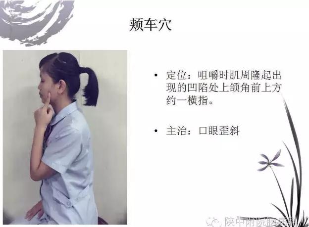 面神经炎的中医诊疗与中医护理