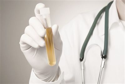 小便有细小泡沫散得很慢为什么,小便泡沫消失得快好不好