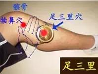 艾灸疗法调理经络不通,艾灸治疗肢体不温