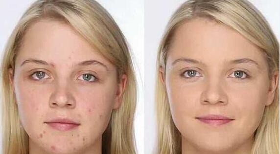 好用遮瑕排行,美妆教程哪种遮瑕好