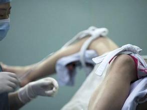 无痛人流和不无痛人流区别是什么,人流可以无痛吗