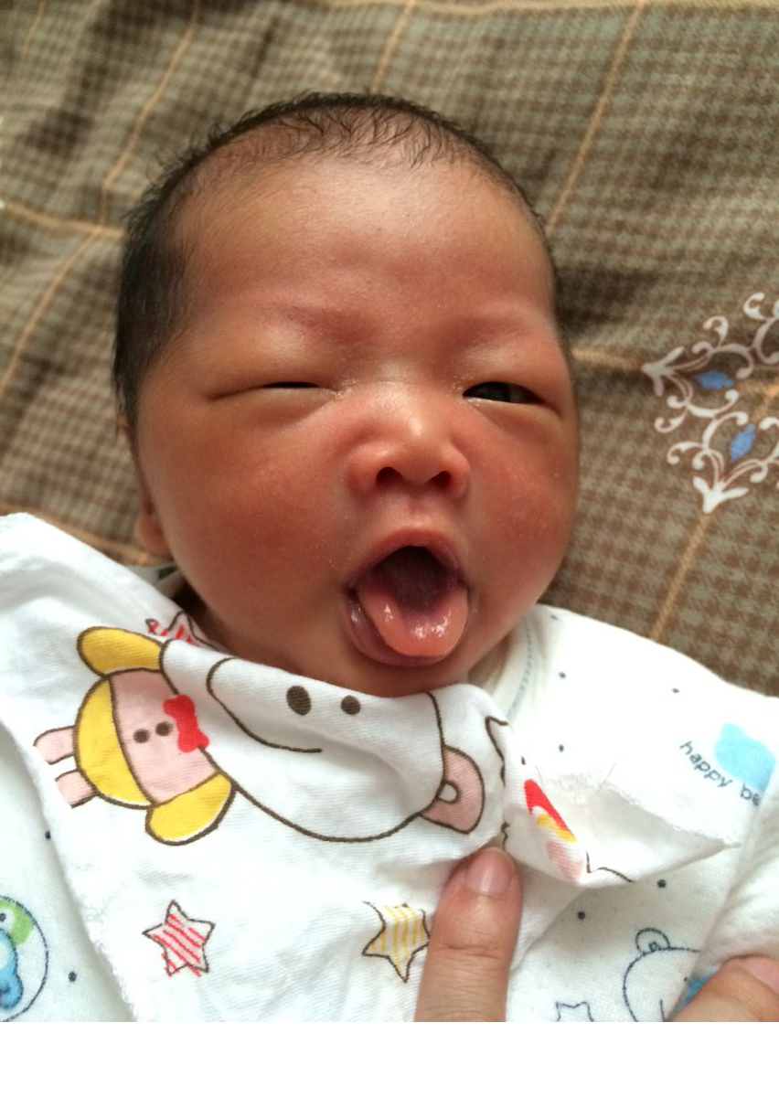 我就是妇产科主任说的30年难得一见的病人​