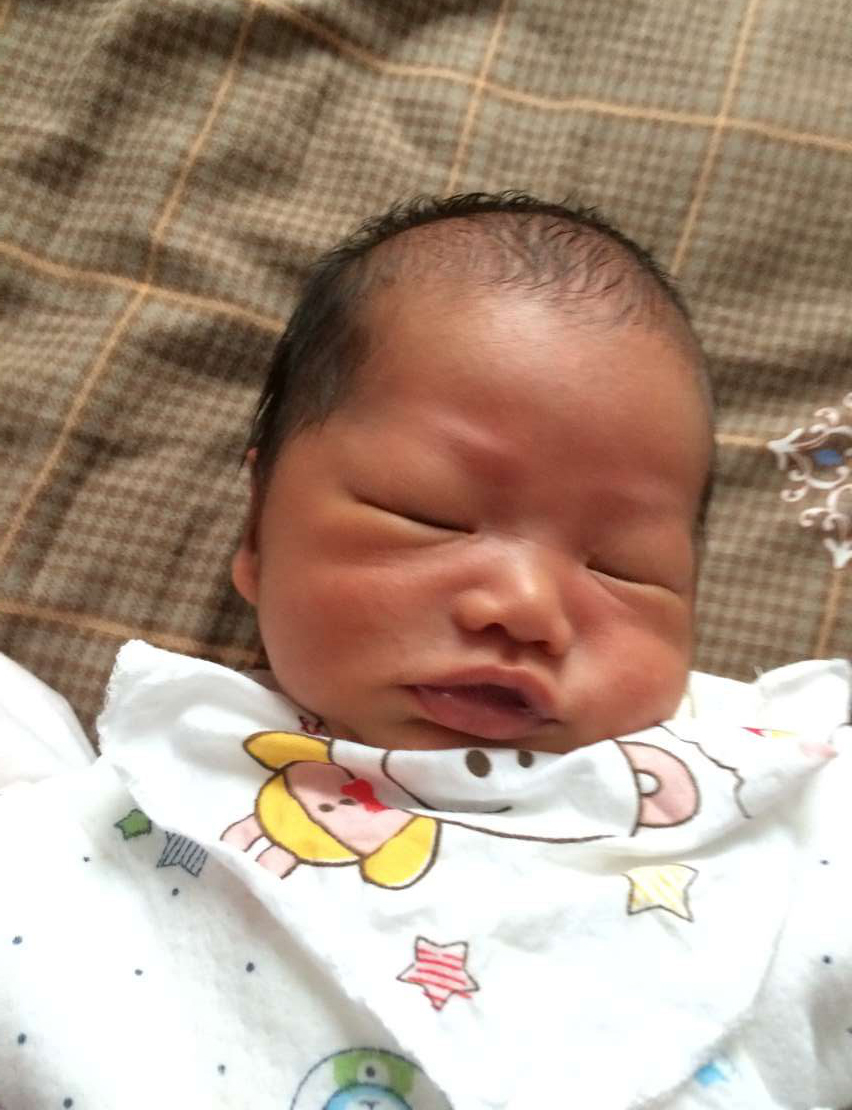 我就是妇产科主任说的30年难得一见的病人​