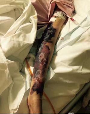 治癌症，该不该信“老中医”？