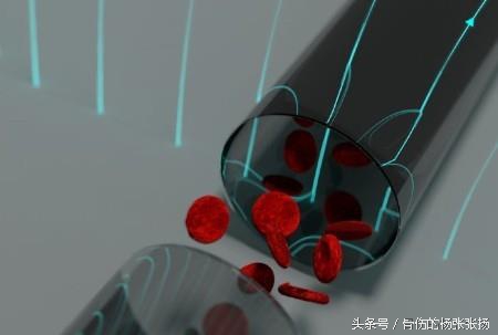 贫血补气血的小妙招,贫血如何补有奶吃