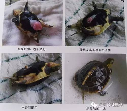 龟水肿的治疗方法,龟水肿是什么症状