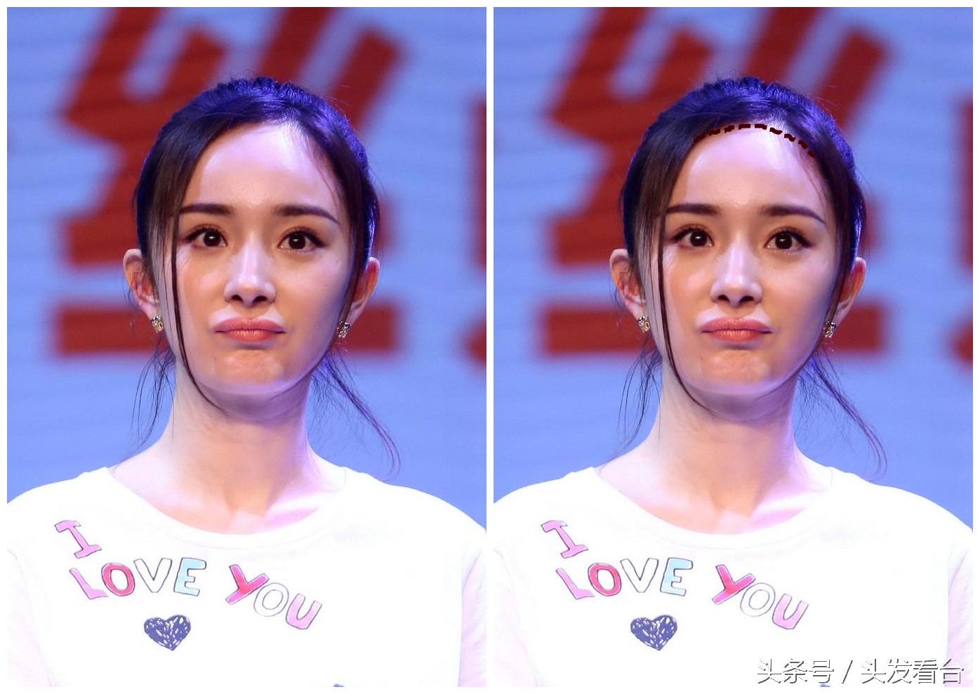 杨幂唐嫣发际线高怎么办,杨幂发际线高唐嫣发际线高吗