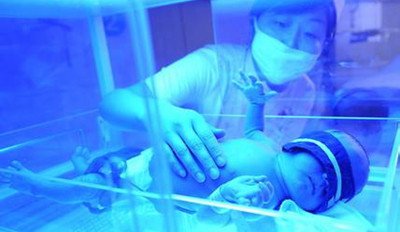 宝宝黄疸禁用茵栀黄怎么办,退黄疸药茵栀黄对小儿有副作用吗