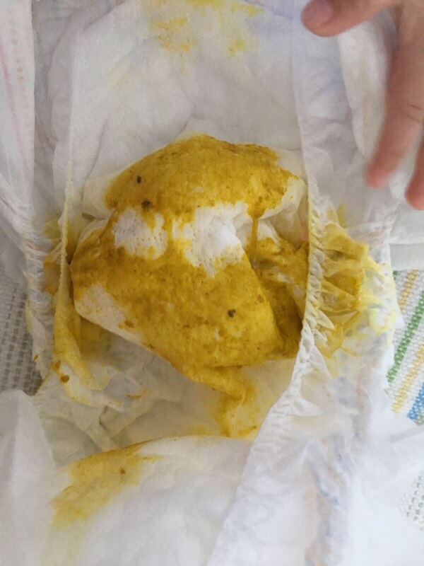 如何防止宝宝受凉腹泻,宝宝怎样可以逃过秋季腹泻