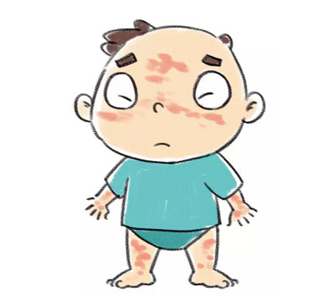 麻疹护理注意事项,新生儿麻疹快速消退方法