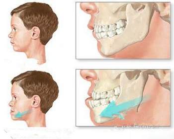婴儿乳牙萌出注意事项,育儿必知道的营养小知识