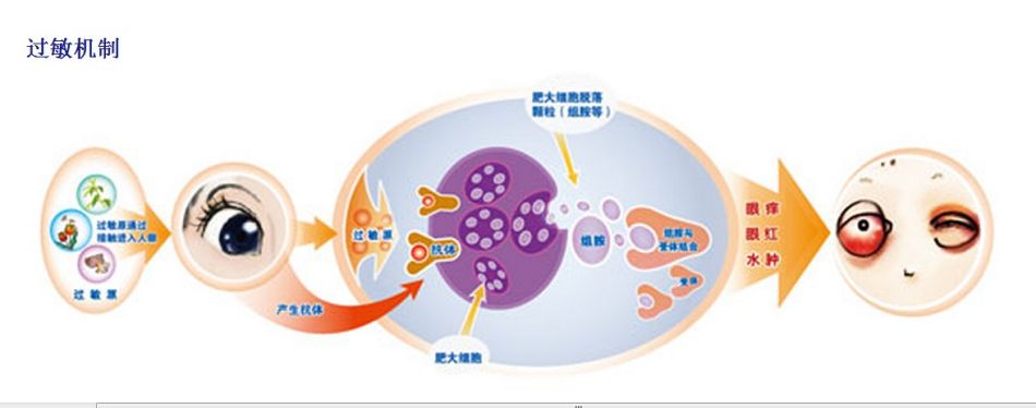 吃海鲜过敏症状表现图片,为什么有人吃海鲜螃蟹过敏