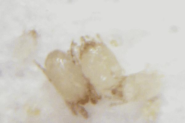 孩子感冒喷嚏打不停还流鼻涕,80天的宝宝感冒咳嗽打喷嚏怎么办