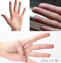 李时珍使用的气血检查法，看看你的气血是否充足？