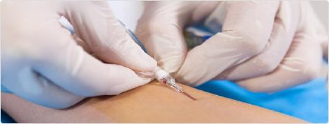 静脉穿刺技巧练习,提高穿刺技术小技巧