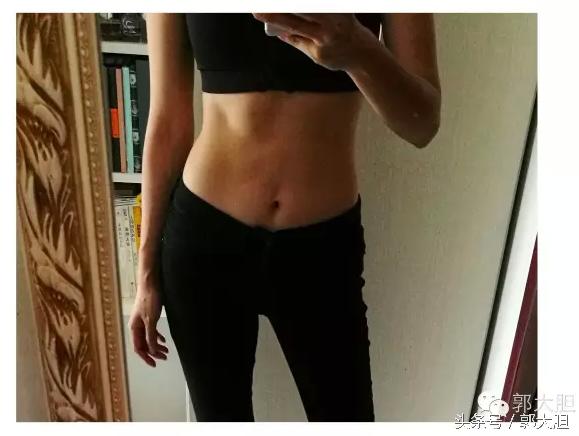 当你以为抗老还要靠超声刀的时候,我去打了更牛X的热拉提