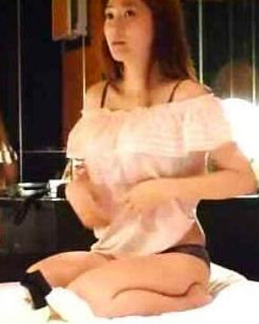 怎么正确使用粉刺针去粉刺,粉刺针的正确用法祛痘