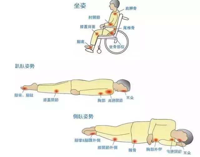 养生有哪些重要,养生有些慢性疾病是可以预防的