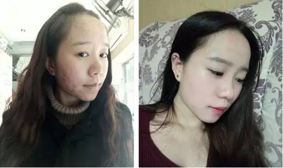 快节奏生活中的美妆小心得｜HowToGetClearerSkin｜AD