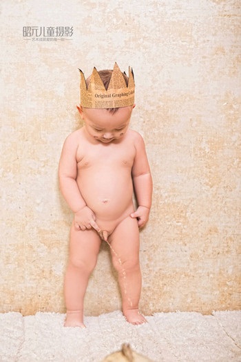 宝宝肚脐突出脐疝怎么恢复,宝宝肚脐突出脐疝是什么原因