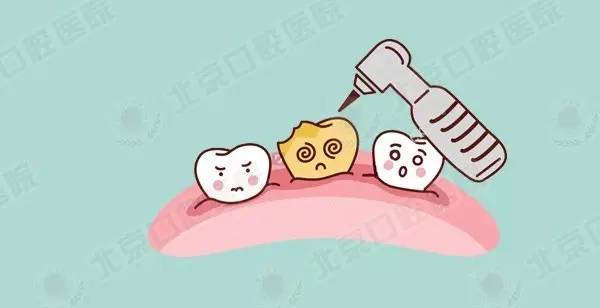 六龄齿及时修复还会继续坏吗,为什么要特别注意保护六龄齿