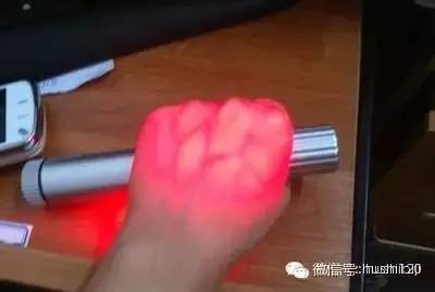 如何扎针不痛,怎么扎针才能不疼