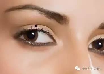 红痣与黑痣对人体健康的影响,红痣竟是健康信号灯