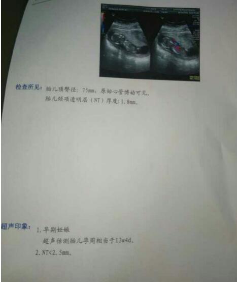 胎停过后我重拾心情，分享经验教训喜获宝宝