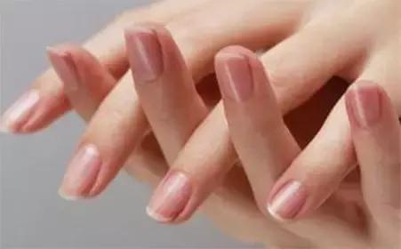 这些指甲变化预示健康玄机,指甲透露哪些健康信息