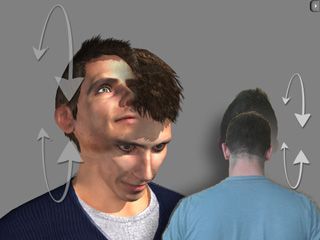 吞咽障碍患者发生误吸的紧急处理,吞咽障碍导致误吸的预防案例