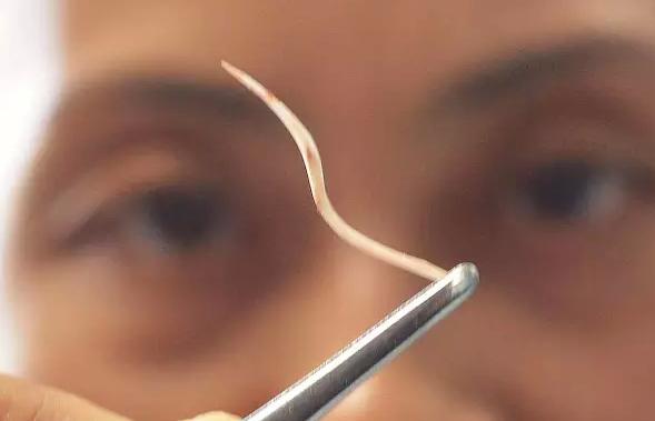 各种大病集中爆发该如何应对,有什么小病不严重但很难受