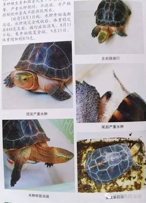 龟水肿的治疗方法,龟水肿是什么症状