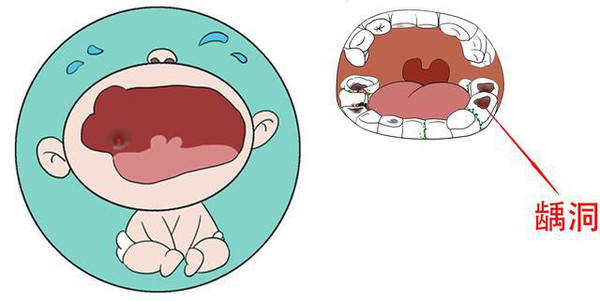婴儿乳牙萌出注意事项,育儿必知道的营养小知识