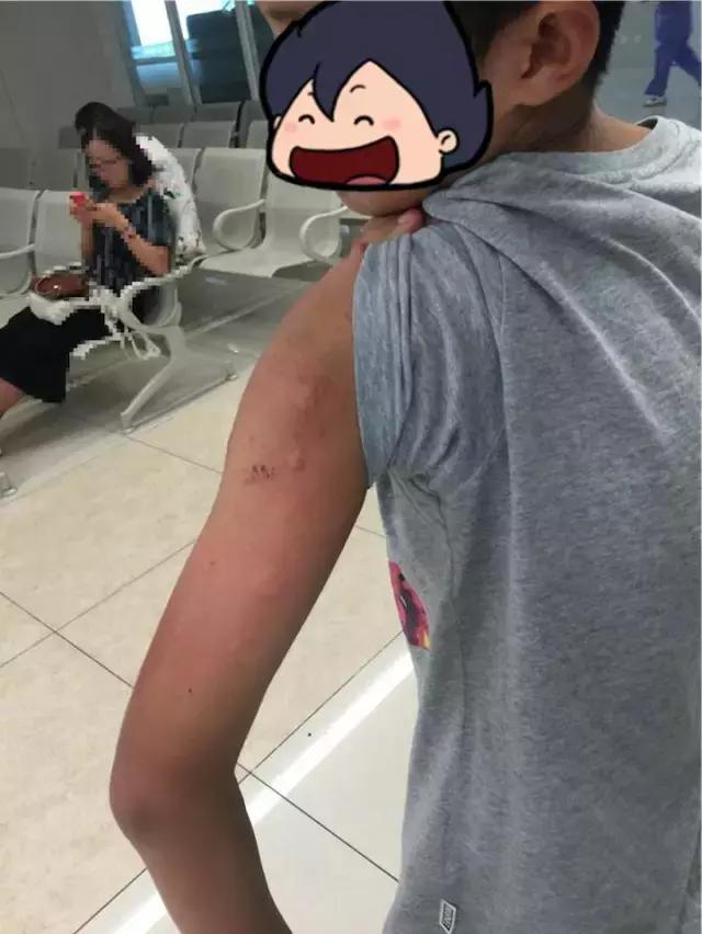 孩子感冒喷嚏打不停还流鼻涕,80天的宝宝感冒咳嗽打喷嚏怎么办