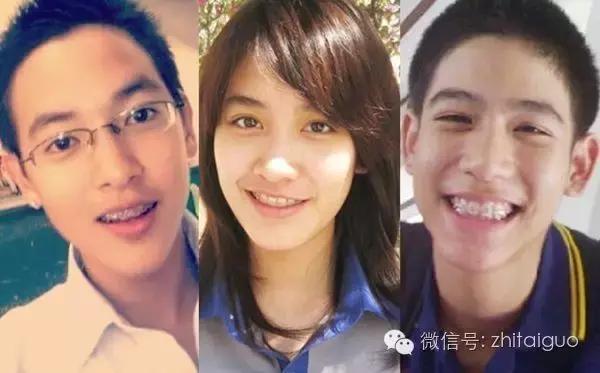 整容失败有多可怕,整容失败多可怕