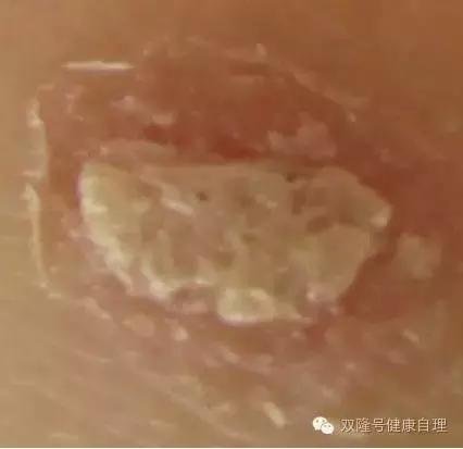 中医说吃醪糟的好处,中医说伤阴最严重症状