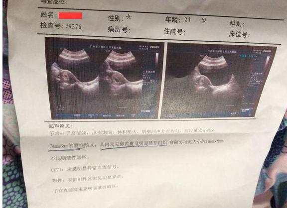 早孕保胎的7大误区，很多孕妇还不知道！