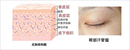 眼睛上边有个小颗粒,眼睛上有个米粒大小的颗粒