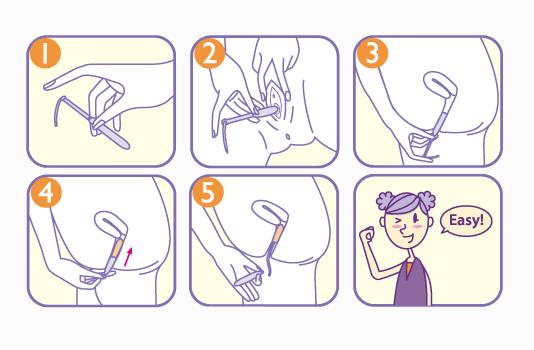 卫生棉条正确使用方法,卫生棉条正确使用方式