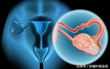 宫颈癌怎么治疗好得快啊,中医对宫颈癌的认识和治疗