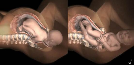 准备顺产的孕妈需要注意什么,顺产妈妈需要准备什么东西进产房