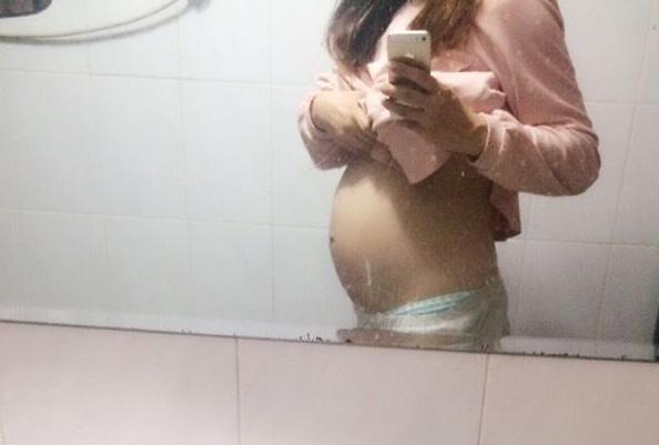 孕晚期妊娠瘙痒症原因,妊娠肝内胆汁淤积症瘙痒如何缓解