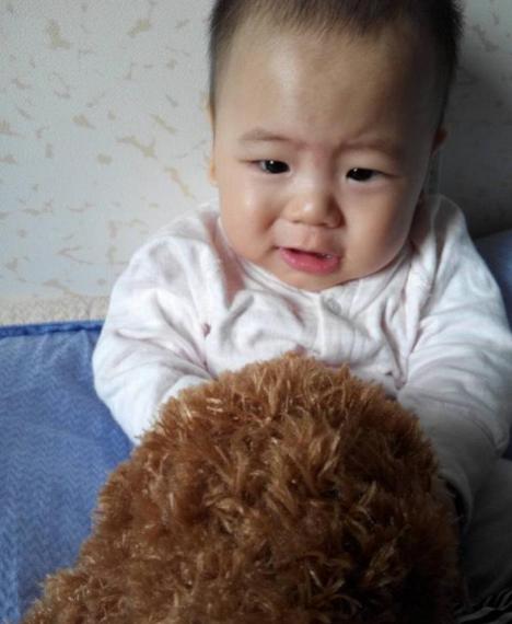 孕晚期妊娠瘙痒症原因,妊娠肝内胆汁淤积症瘙痒如何缓解