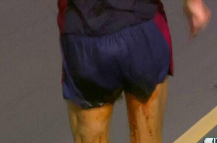 跑马怎么避免拉屎,跑马后出现呕吐腹泻怎么办