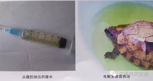 龟水肿的治疗方法,龟水肿是什么症状