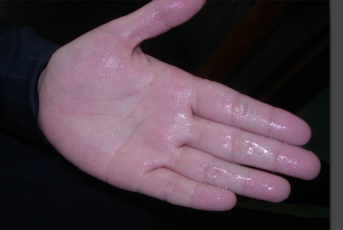 治出汗最好的一味中药,治多汗症的药方