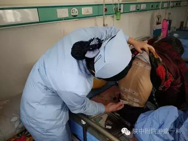 中西医结合治疗肺癌的好处,中西医结合怎么治疗肺癌