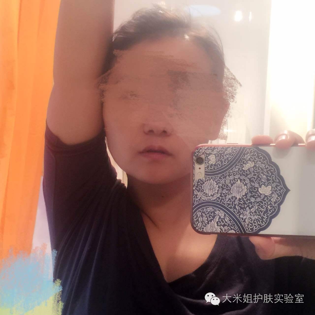 揭秘快速美白祛斑套路,祛斑美白技术视频