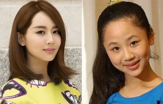 杨紫玻尿酸,杨紫脸部最近是不是又整了