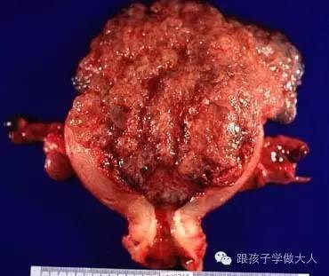 准妈妈有这3个特征,准妈妈出现这些现象